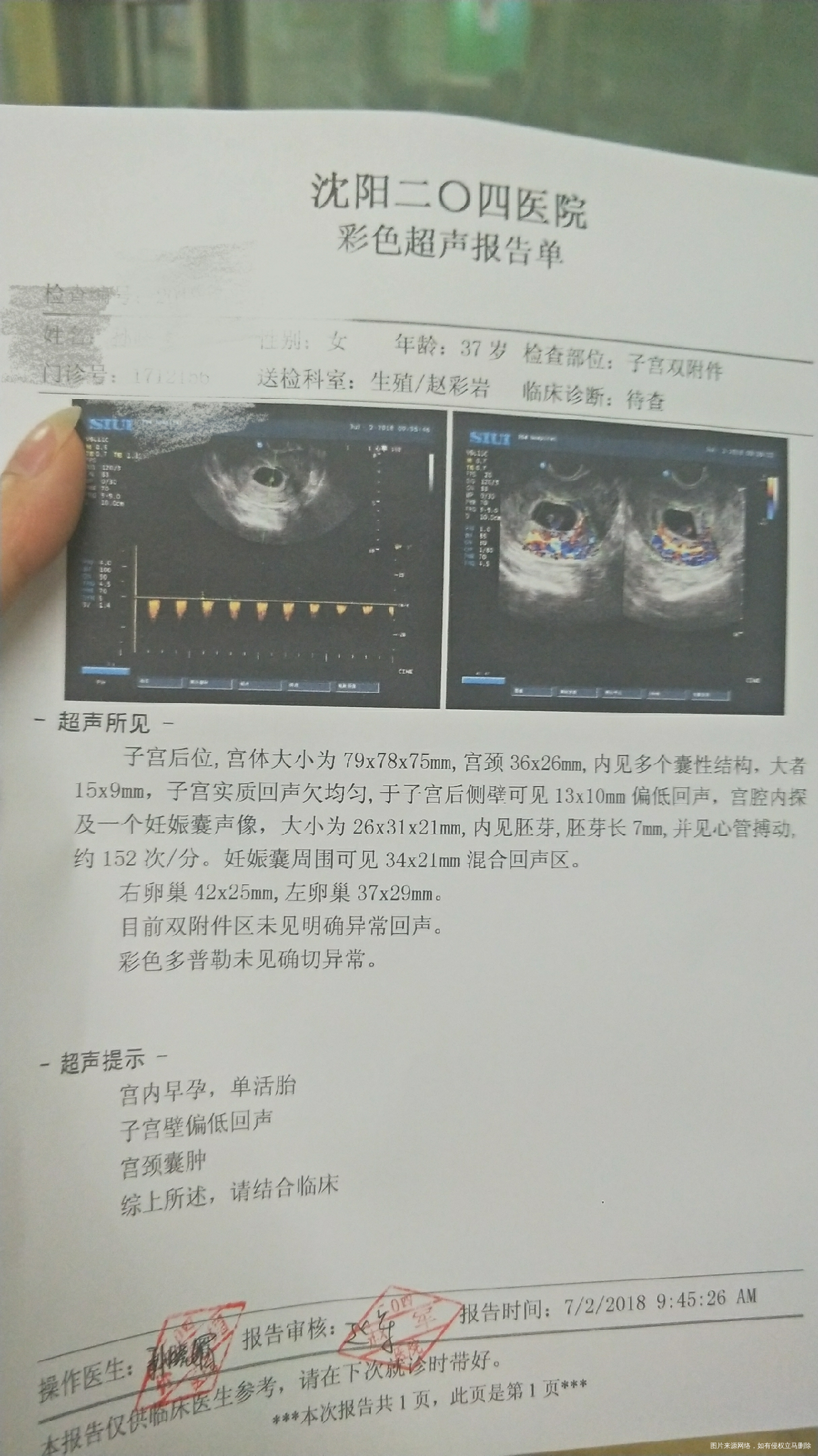 一超回来,一切都顺顺利利的,