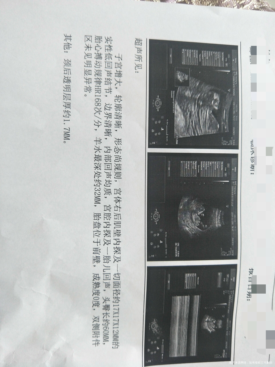 麻烦在线的医生帮帮忙吧!