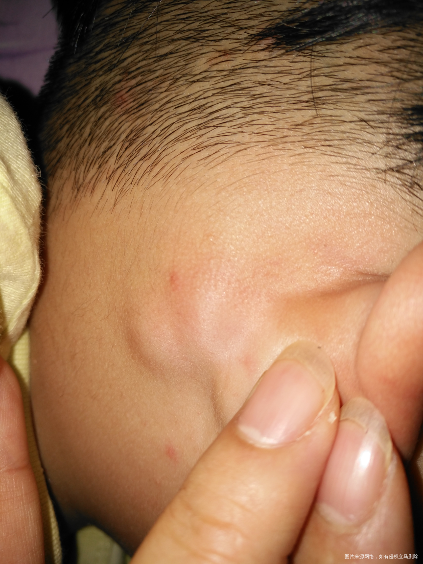 有医生在吗?紧急求助,求助