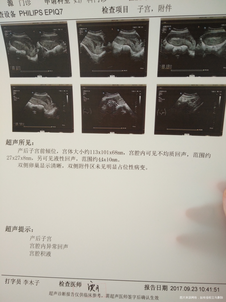 医生帮忙看一下这个需要清宫吗