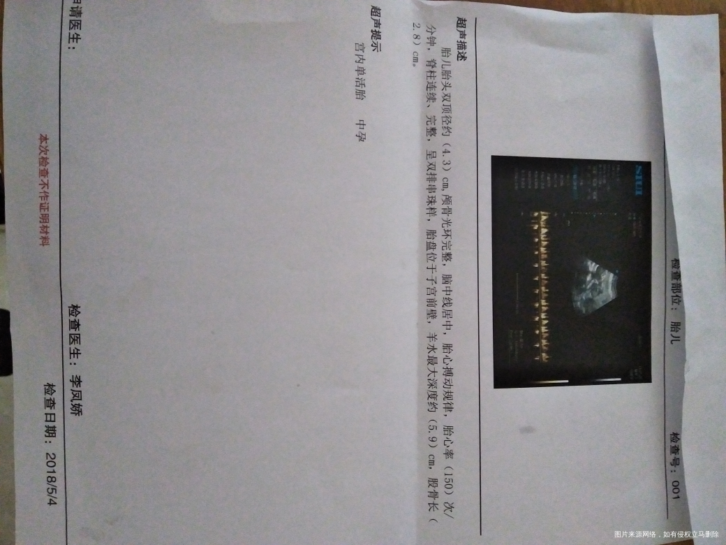 急急急!有医生在吗?帮我看一看b超