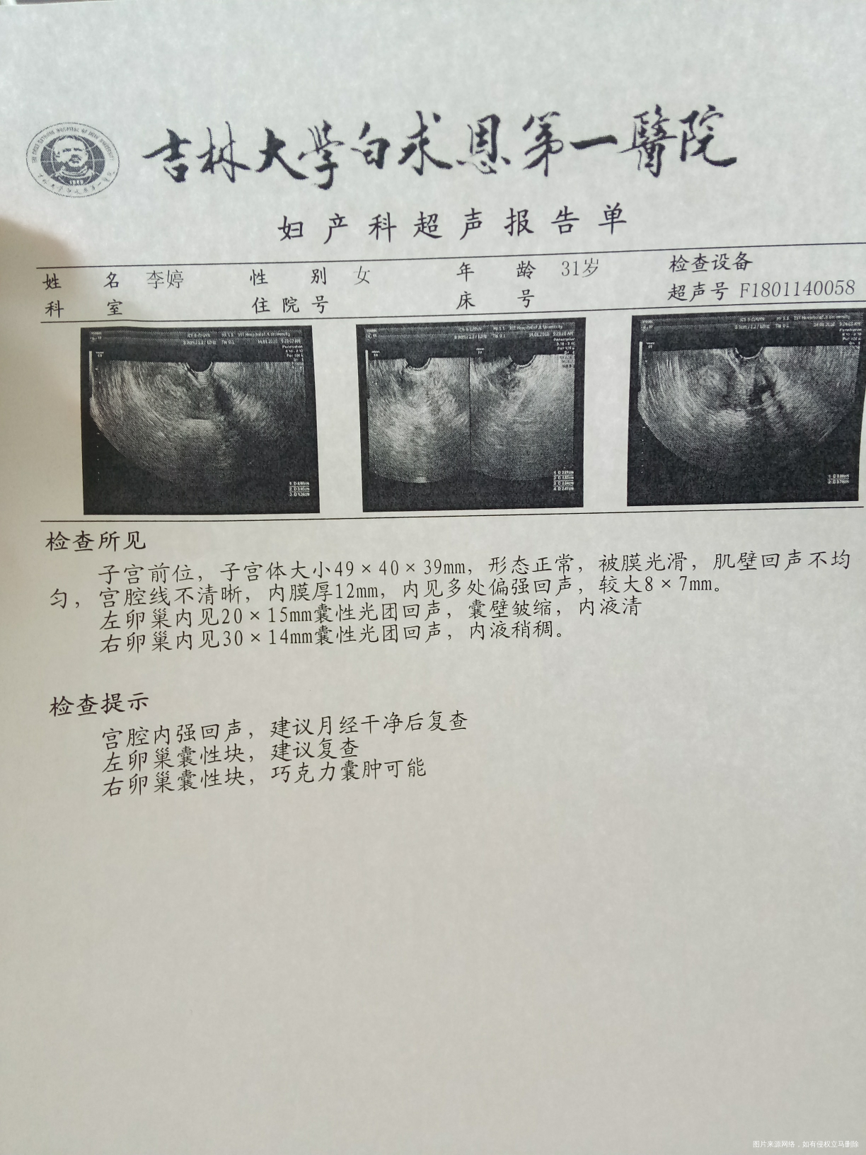 子宫内膜厚,还有息肉,吃地屈孕酮后月经9天还不断