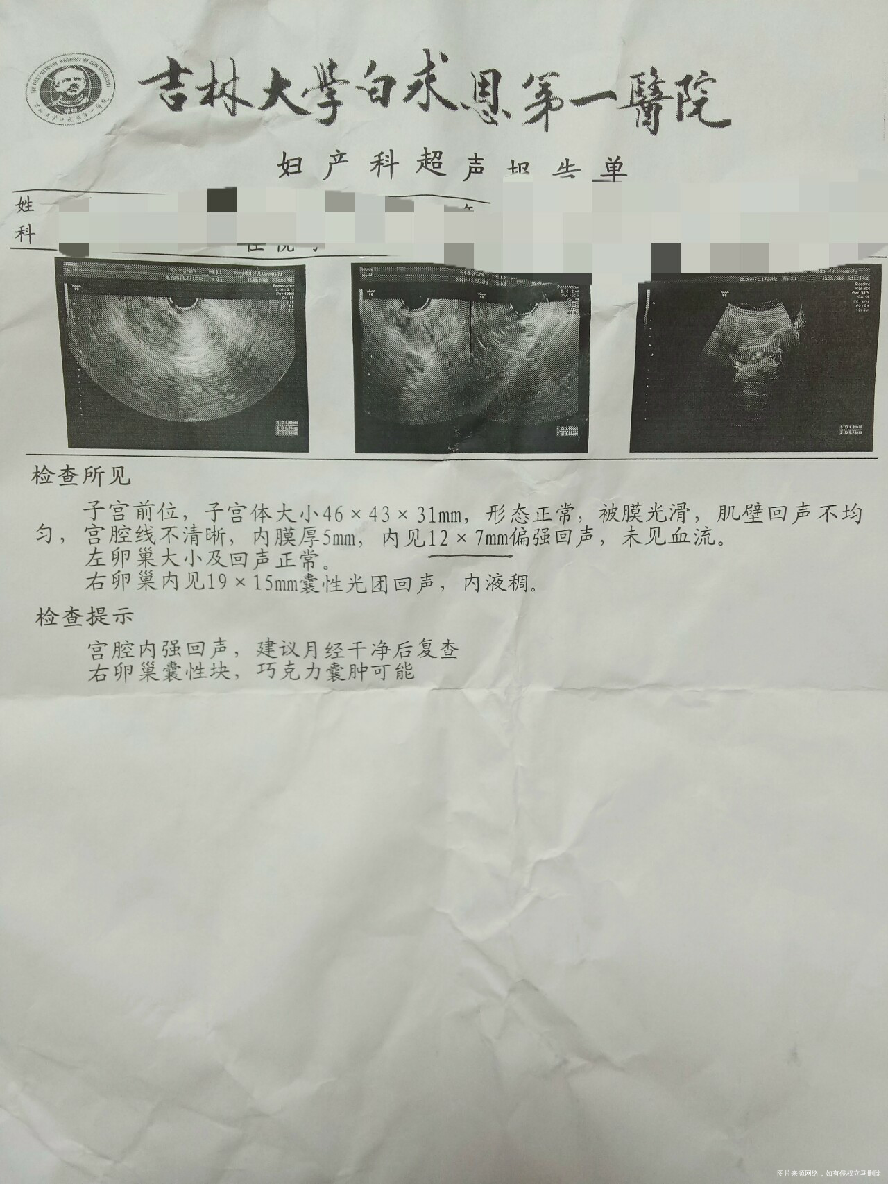 医生帮忙看下，3月27日做的宫腔镜去息肉，这是复查的，