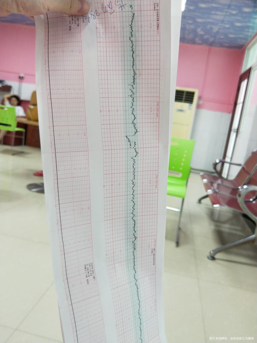 帮我看看这个胎心监护正常吗?