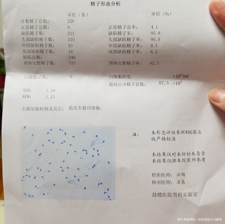 精子畸形率高,刚做了精子碎片检查看不懂