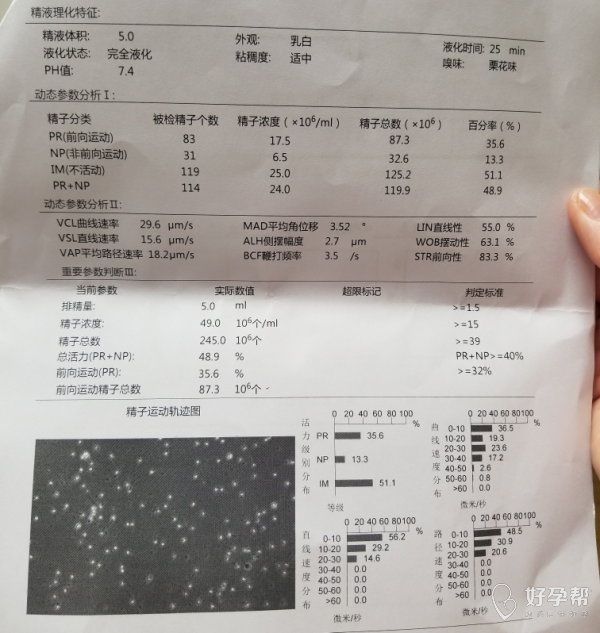 精子畸形率高刚做了精子碎片检查看不懂