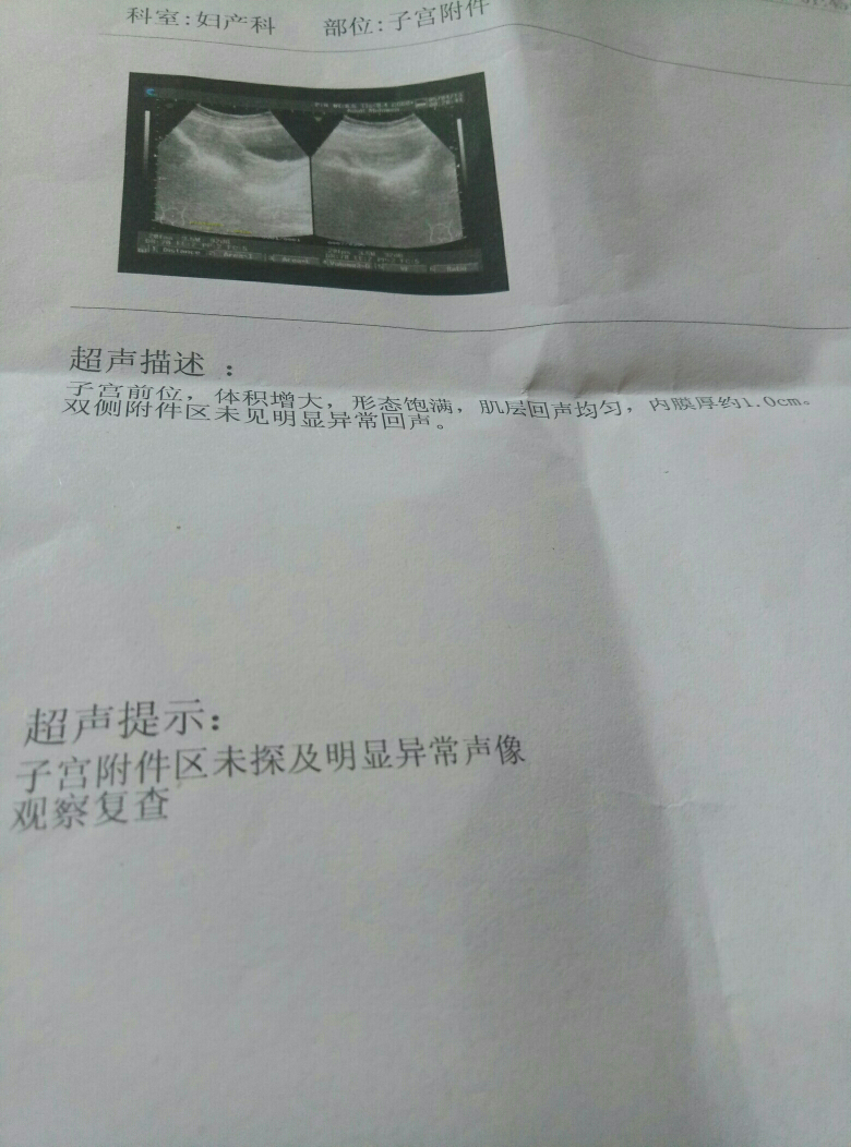 这是我月经推迟快3个月了做的彩超亲们帮我看看有没有怀孕的可能,我