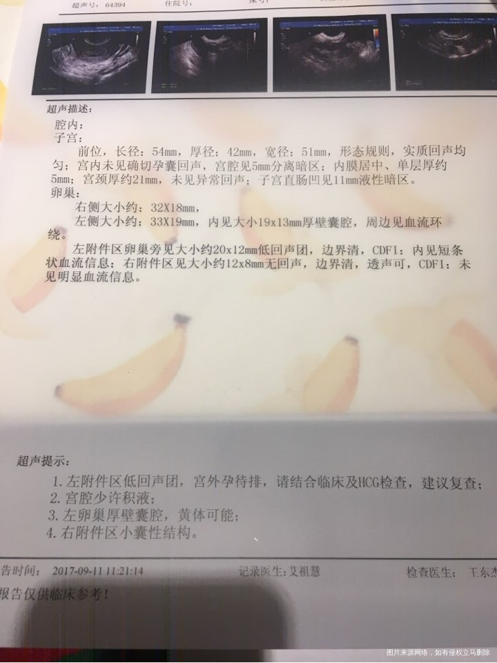 急急急急 好心医生帮我看看吧