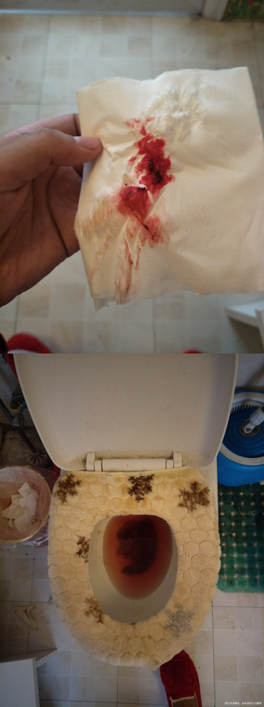 肚子疼!求助医生!有图慎入!