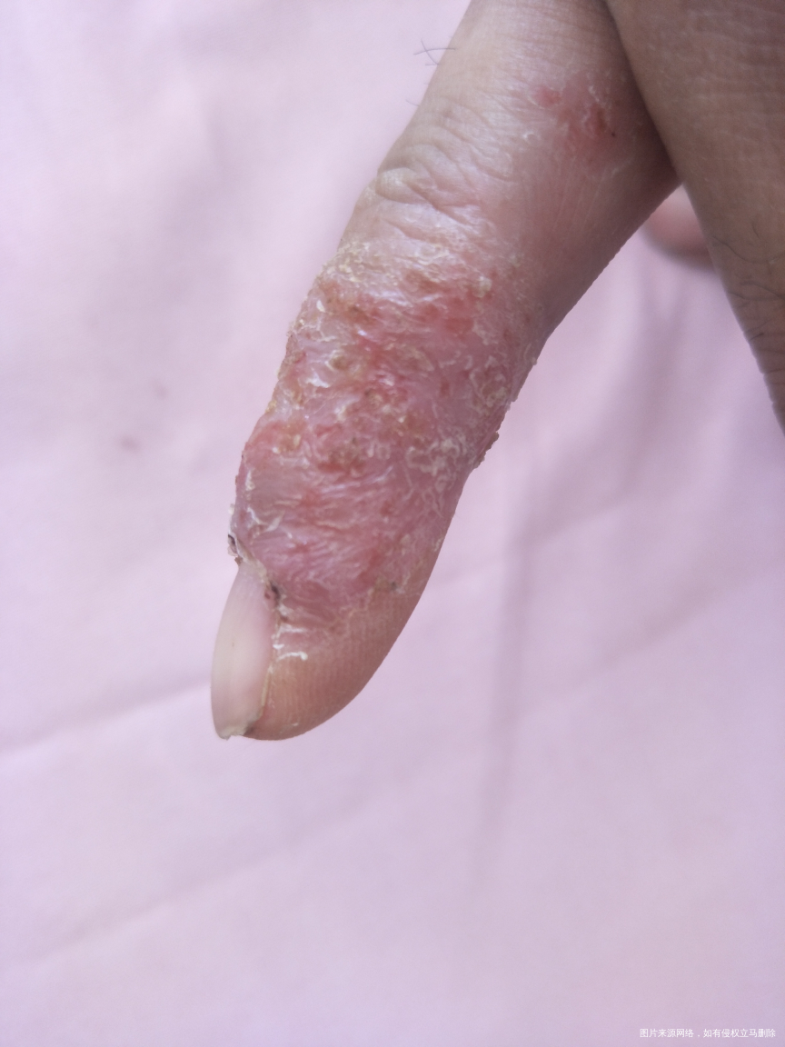 急 麻烦医生看看这个手怎么回事