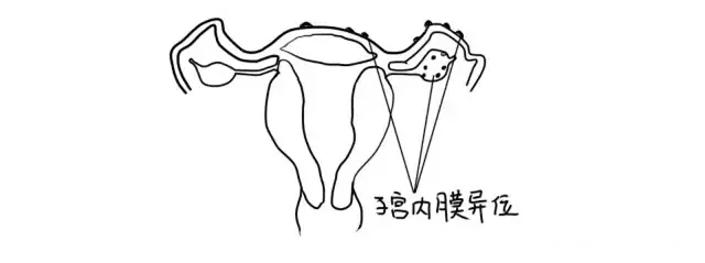 【知识库】黄体功能不全,我还能怀孕吗?