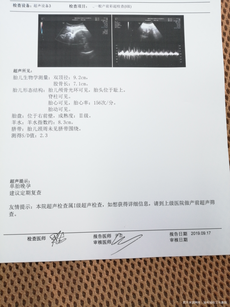 孕38周看看有多重了