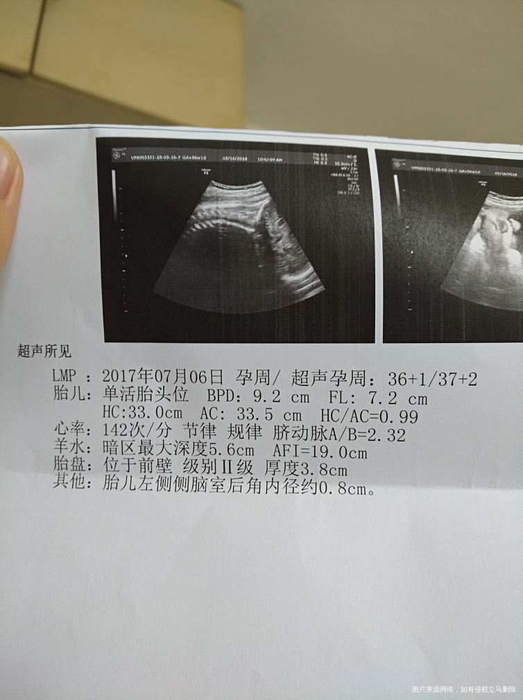 小宝宝的侧脑室有问题吗?现在有几斤了?