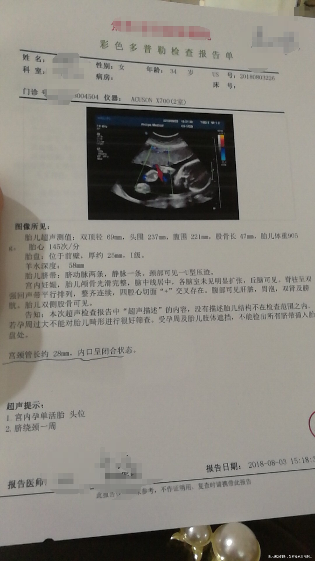 25+3周胎盘一级还能补钙吗?