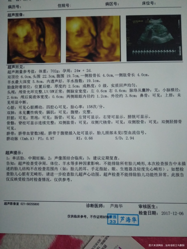 今天刚做的,医院说羊水有点多