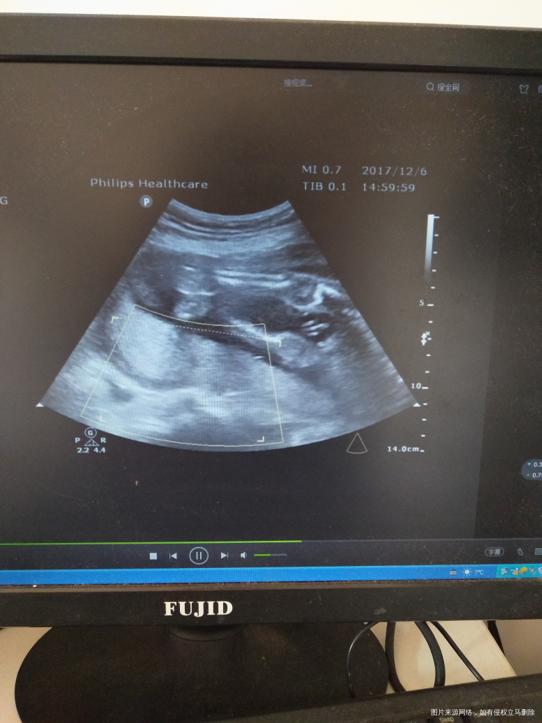 有经验的宝妈可以帮我看一下吗?