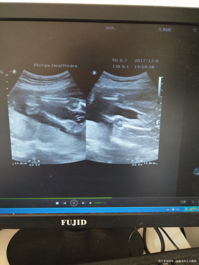 有经验的宝妈可以帮我看一下吗?