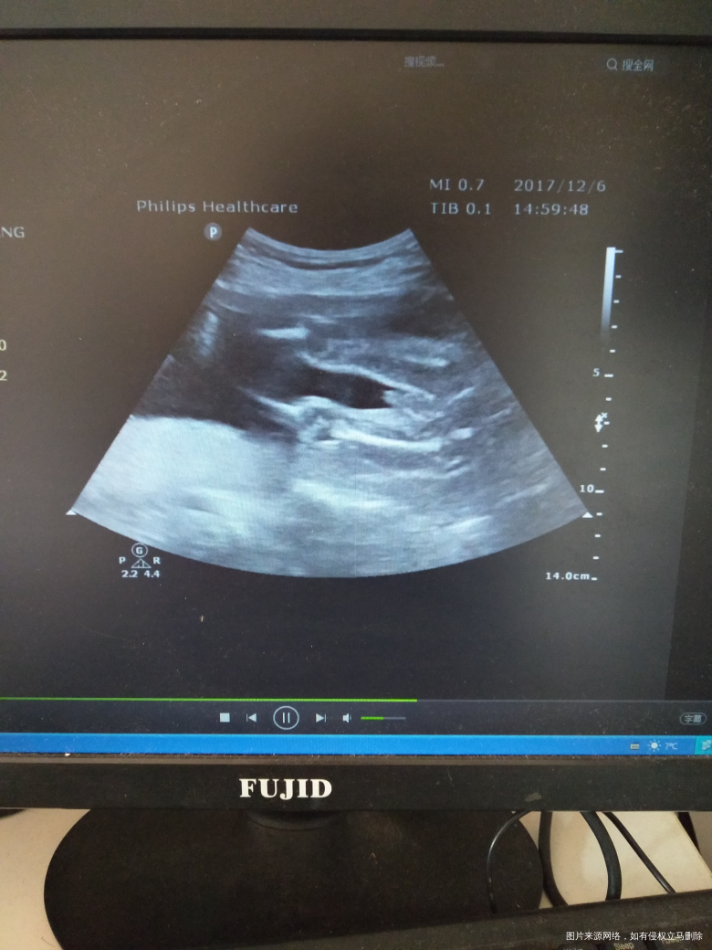 有经验的宝妈可以帮我看一下吗?