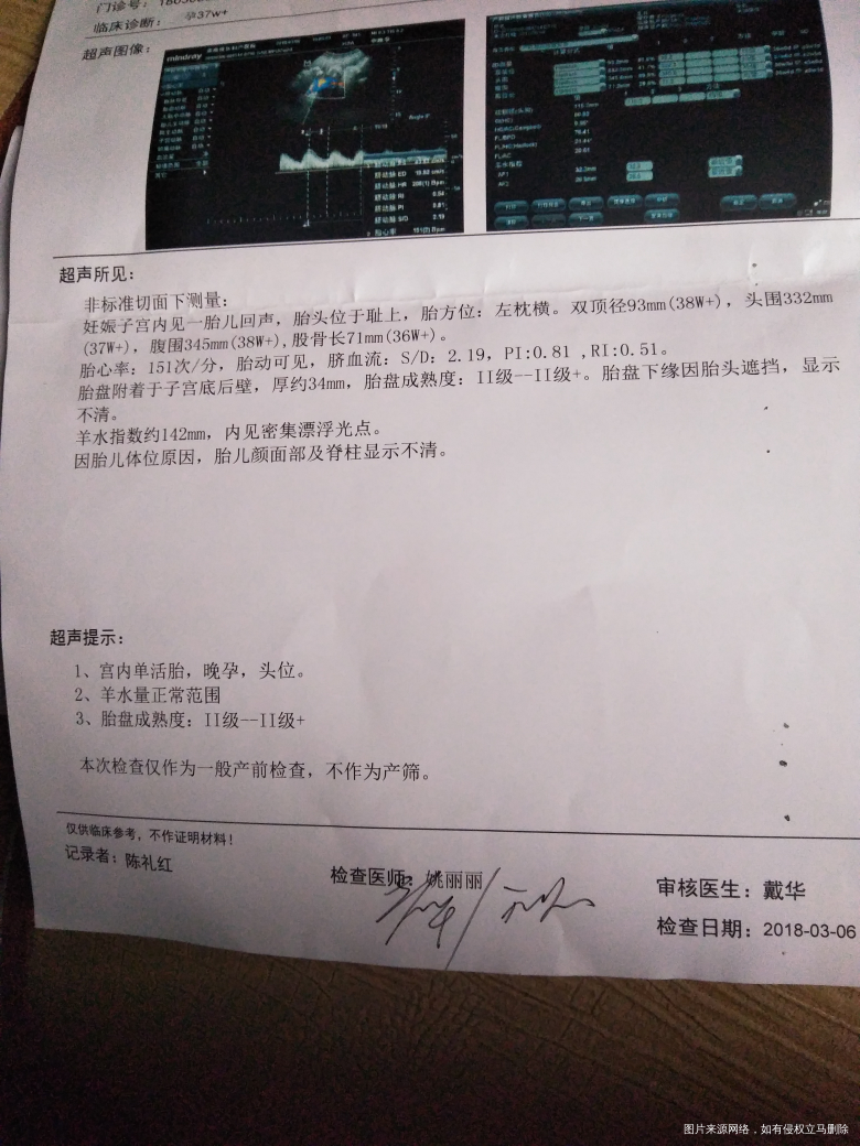 麻烦帮我看下胎盘成熟度现在可以破宫产了吗