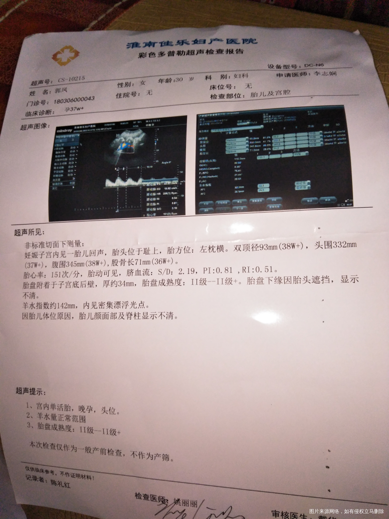 麻烦帮我看下宝宝有多重了