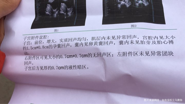 这个是今天的彩超报告,请问正常吗