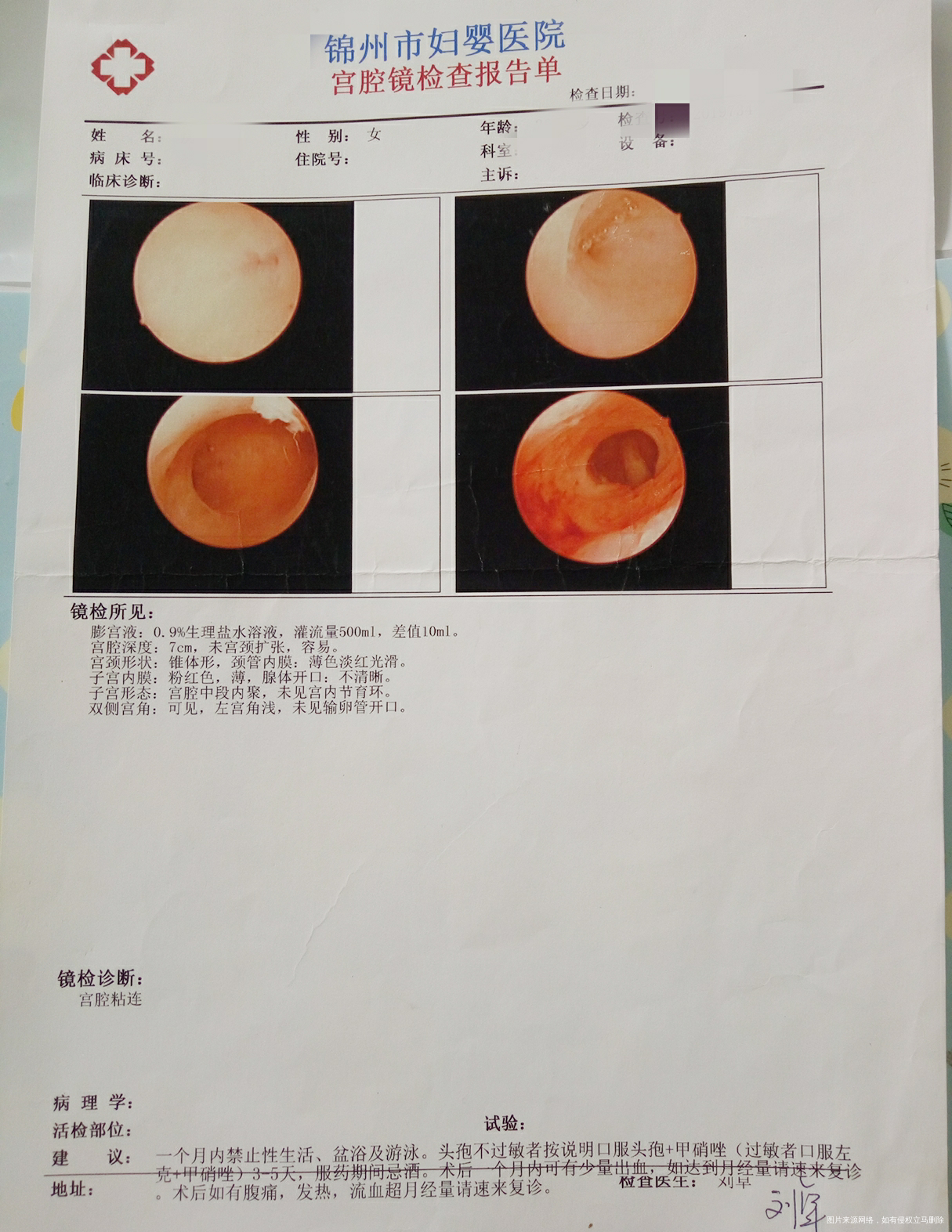 求助医生帮我看下我的报告