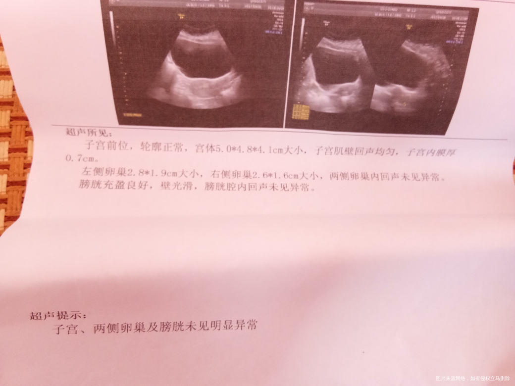 我都46天了怎么b超没有呢