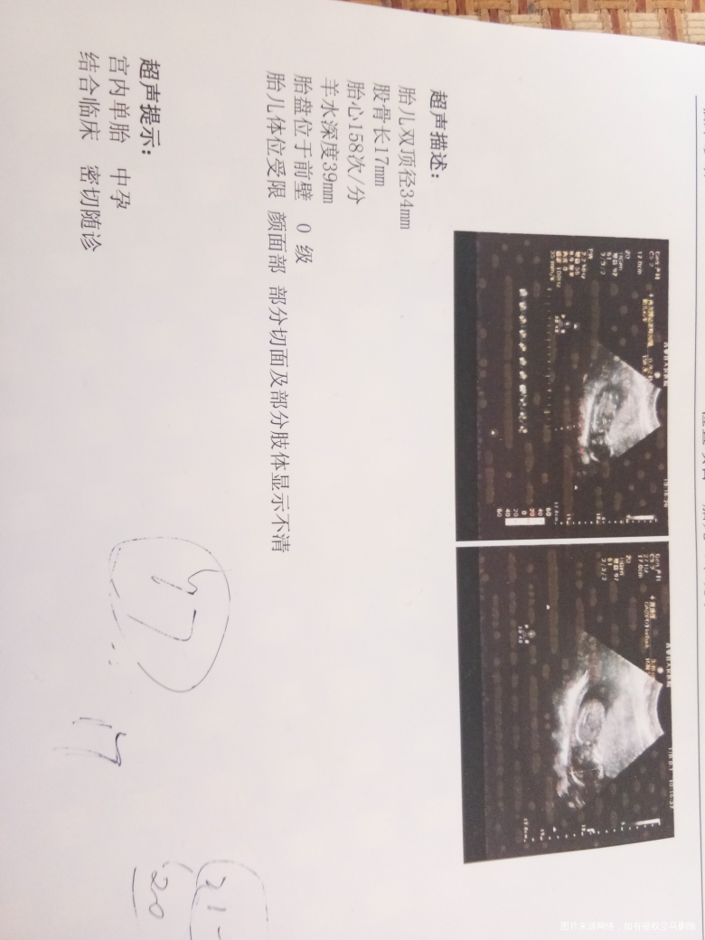 请大夫看看我的结果呀