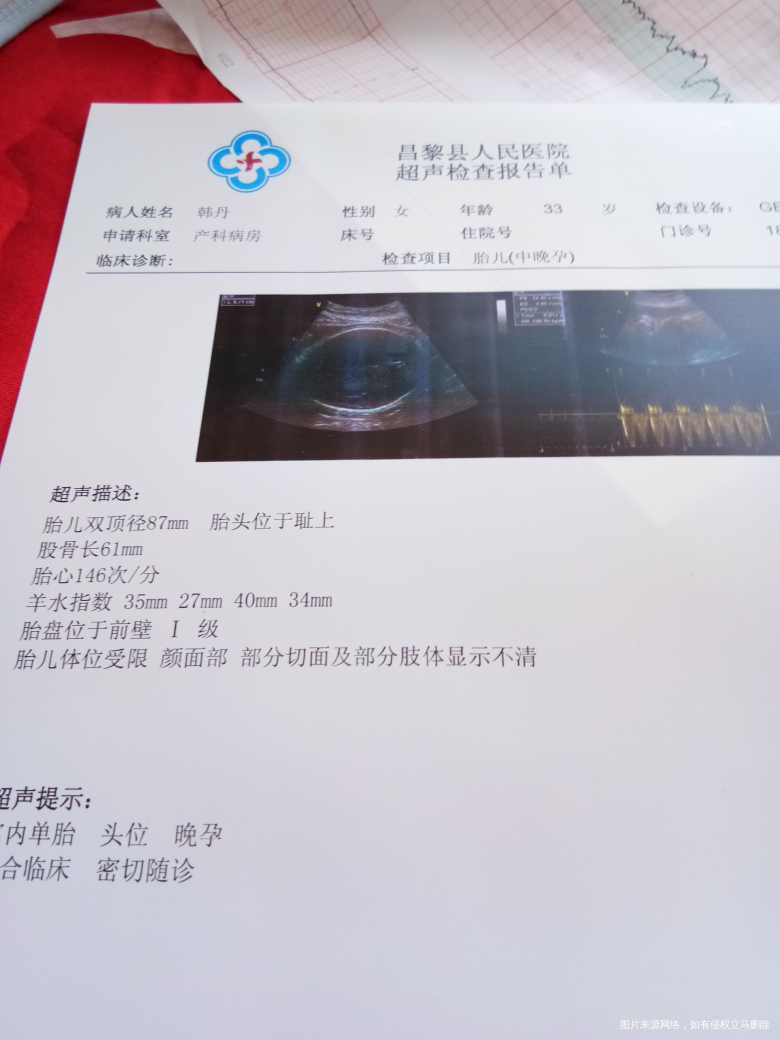 请医生看看孩子有几斤了