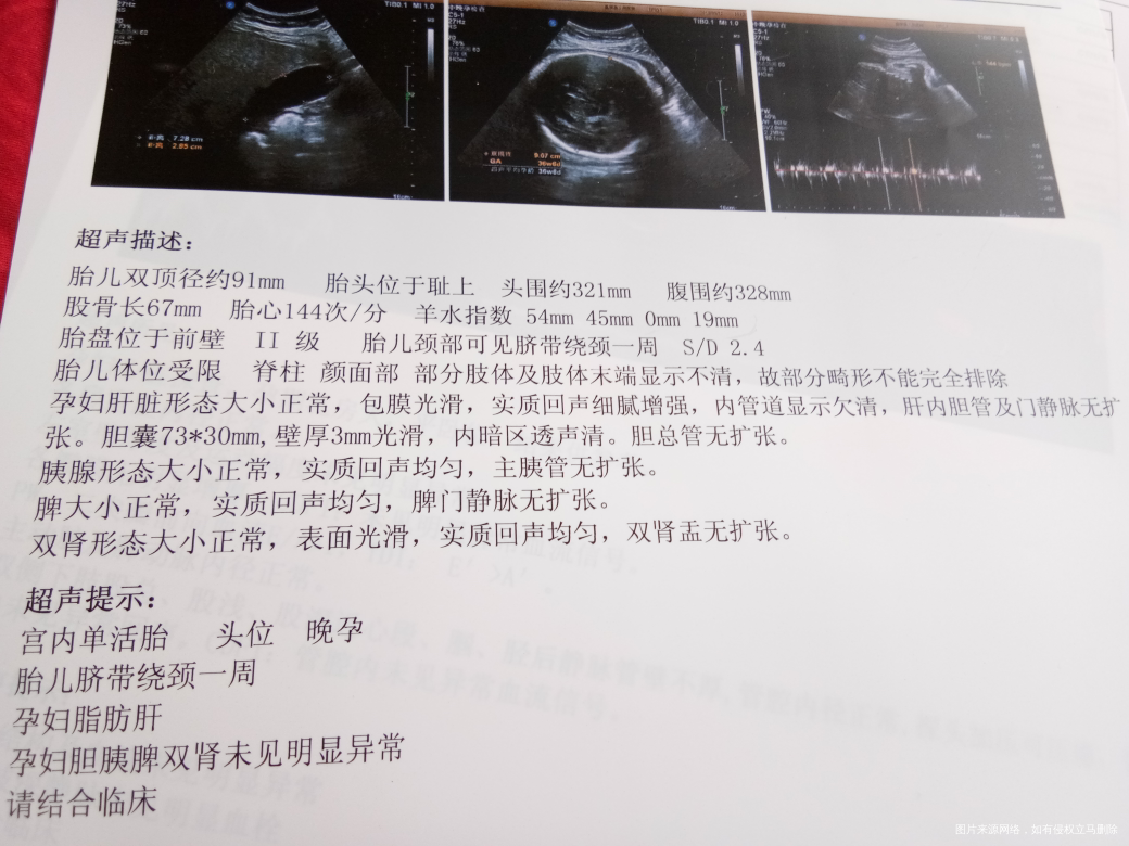 让大夫看看我的检查结果