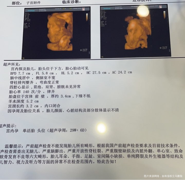 弱精成功怀孕,已经33周啦