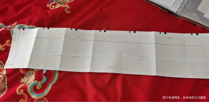 弱精成功怀孕,已经33周啦