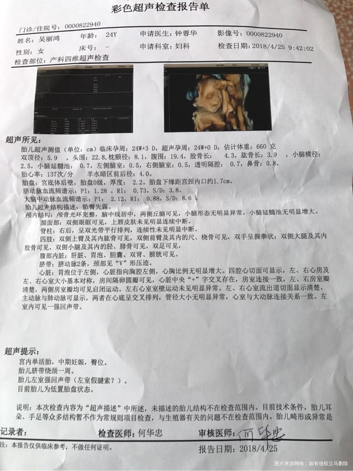 求助医生帮忙看看四维彩超检查结果