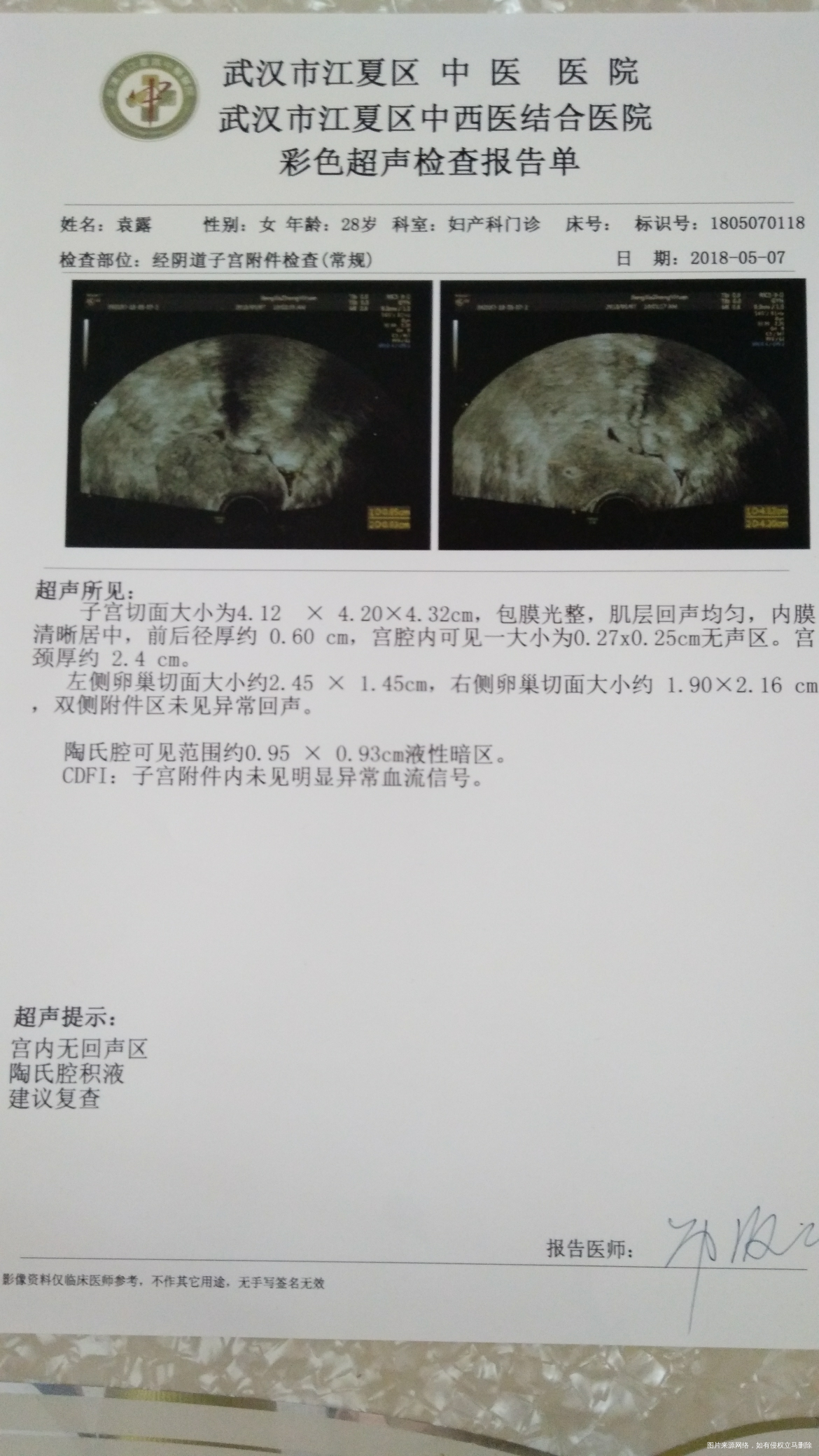 帮我看看正常不,结婚10个月了,还没怀上,急