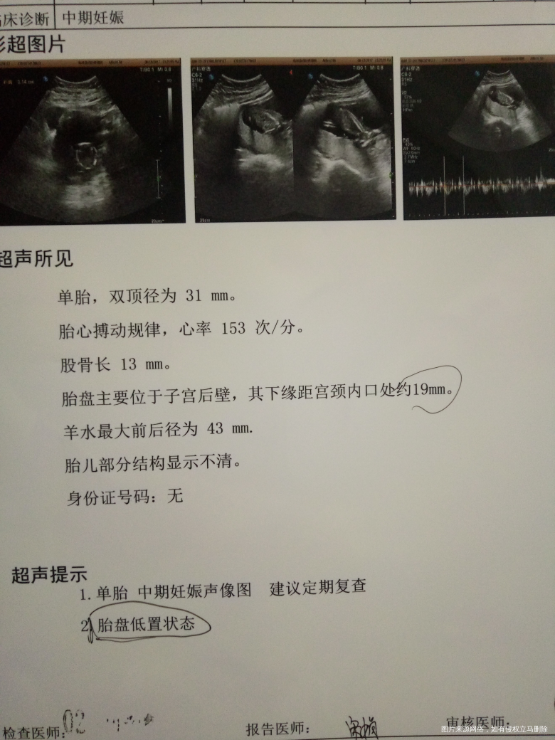 怀孕15周见红,很担心,请医生帮帮我