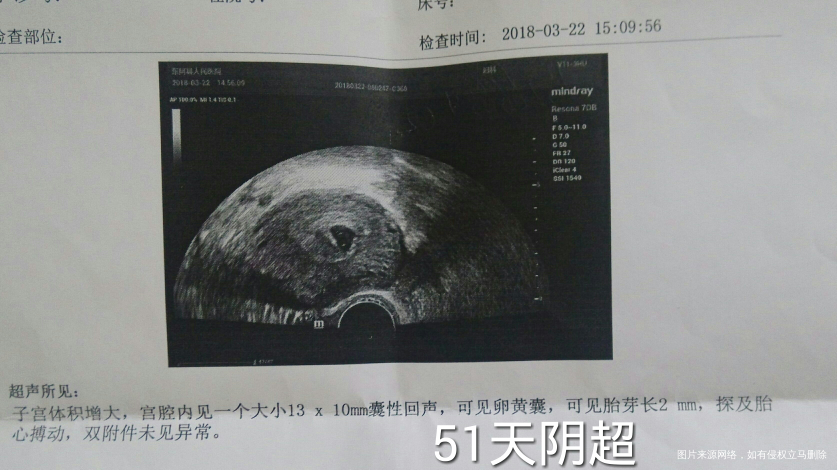 孕酮低且HCG翻倍不好,请明医指点迷津,谢谢!