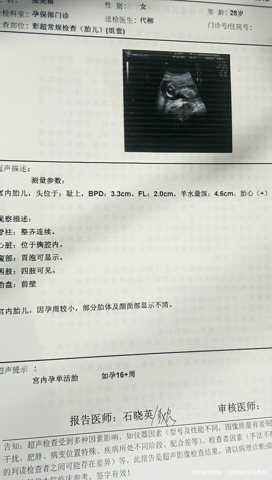 抽血化验的甲功,丙功,血糖,数值帮忙看看!