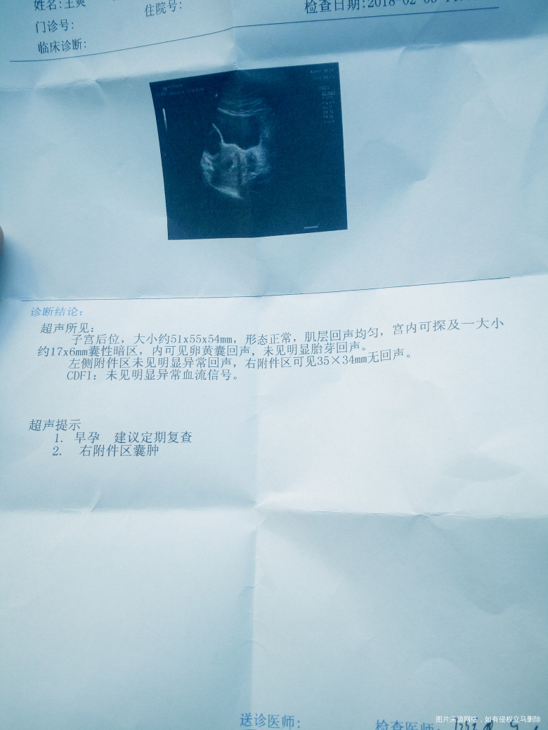 今天孕48天医生帮忙看看着急