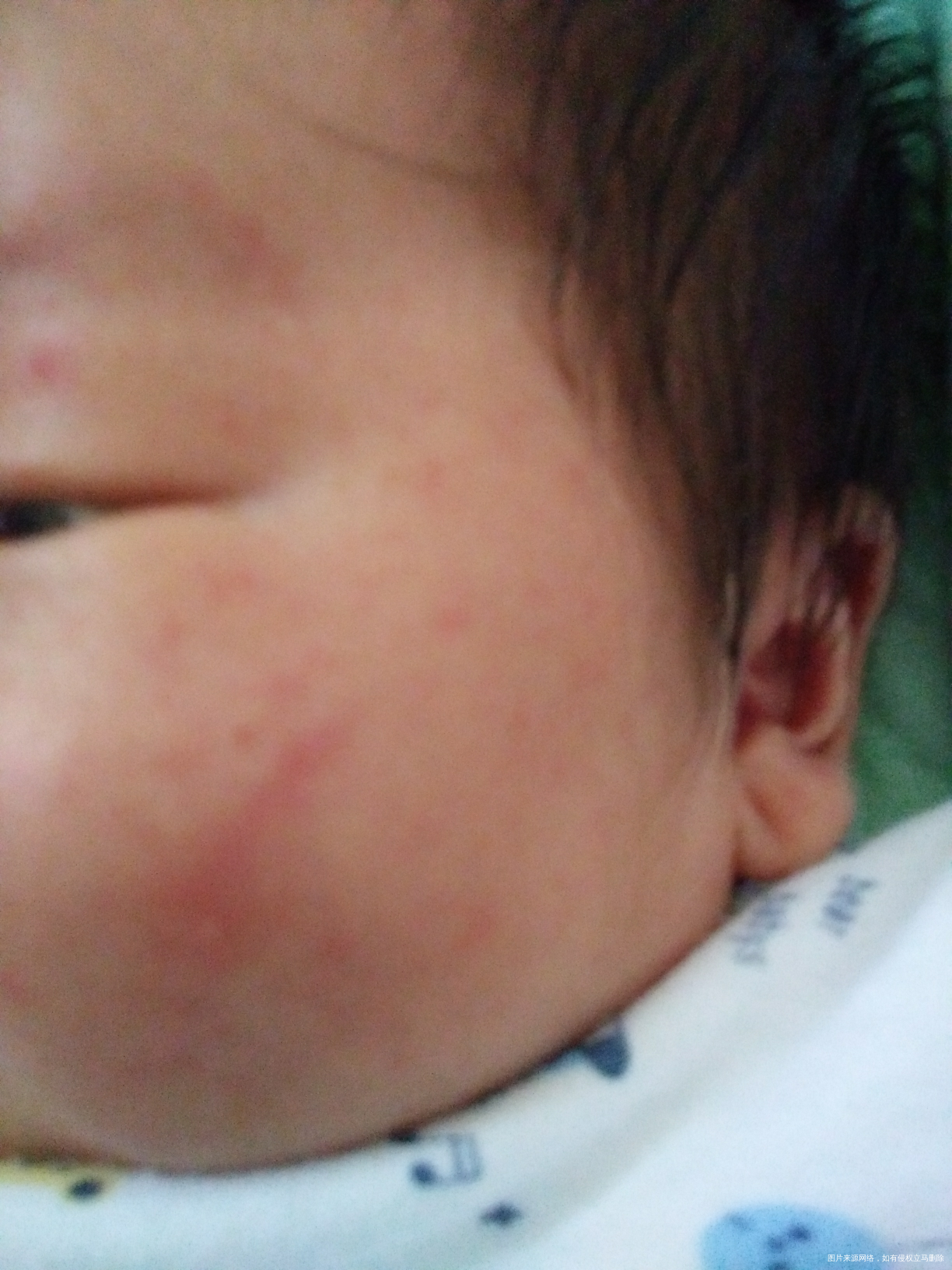 宝宝这脸上起的点点是痱子吗?
