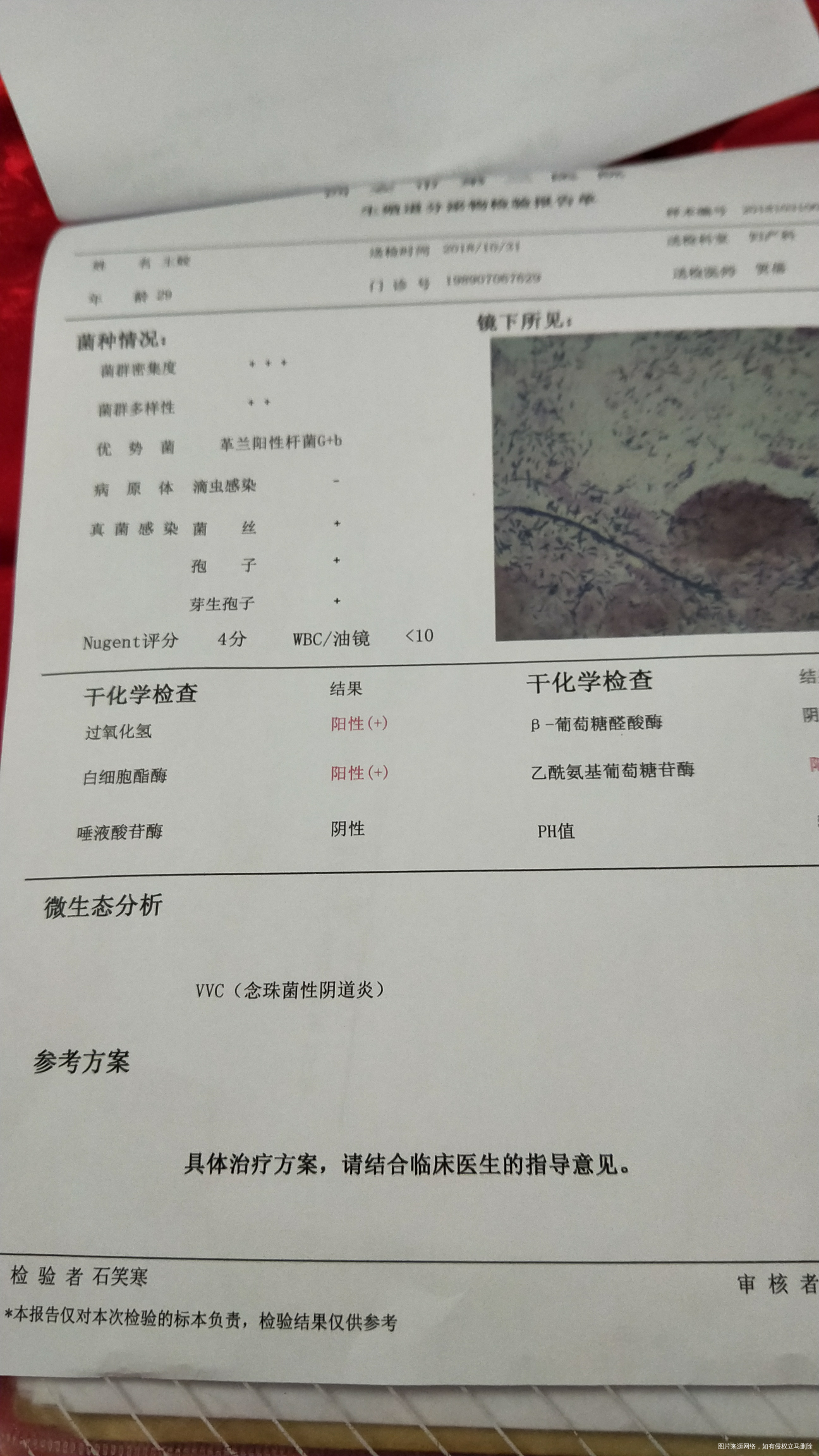 孕期霉菌性阴道炎该怎么治疗