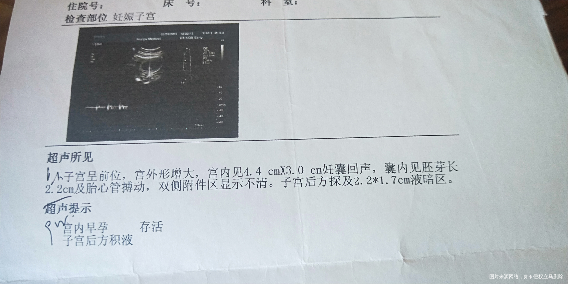 请在线的医生 给我算算预产期