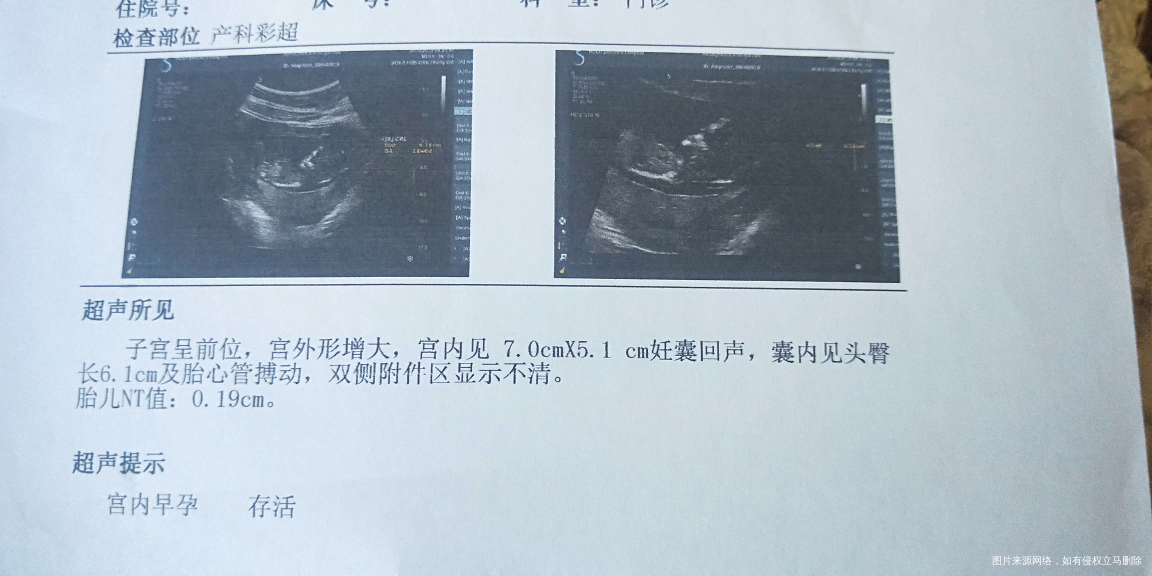 请在线的医生 给我算算预产期