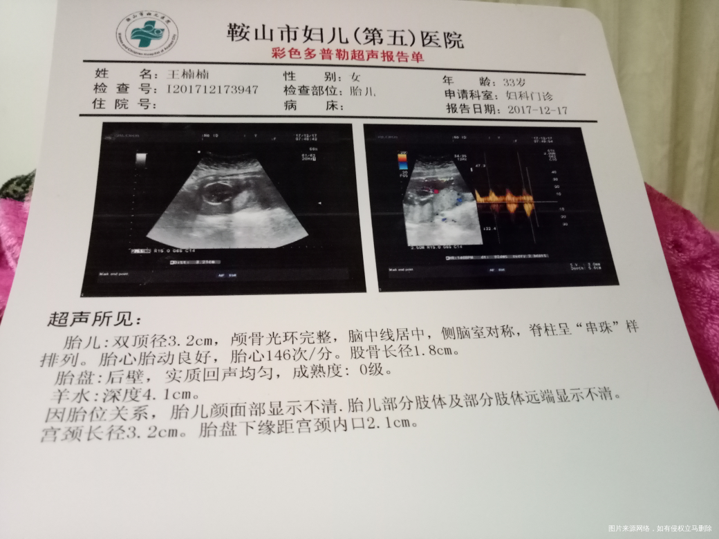 帮我看看我的彩超,看多少周了,