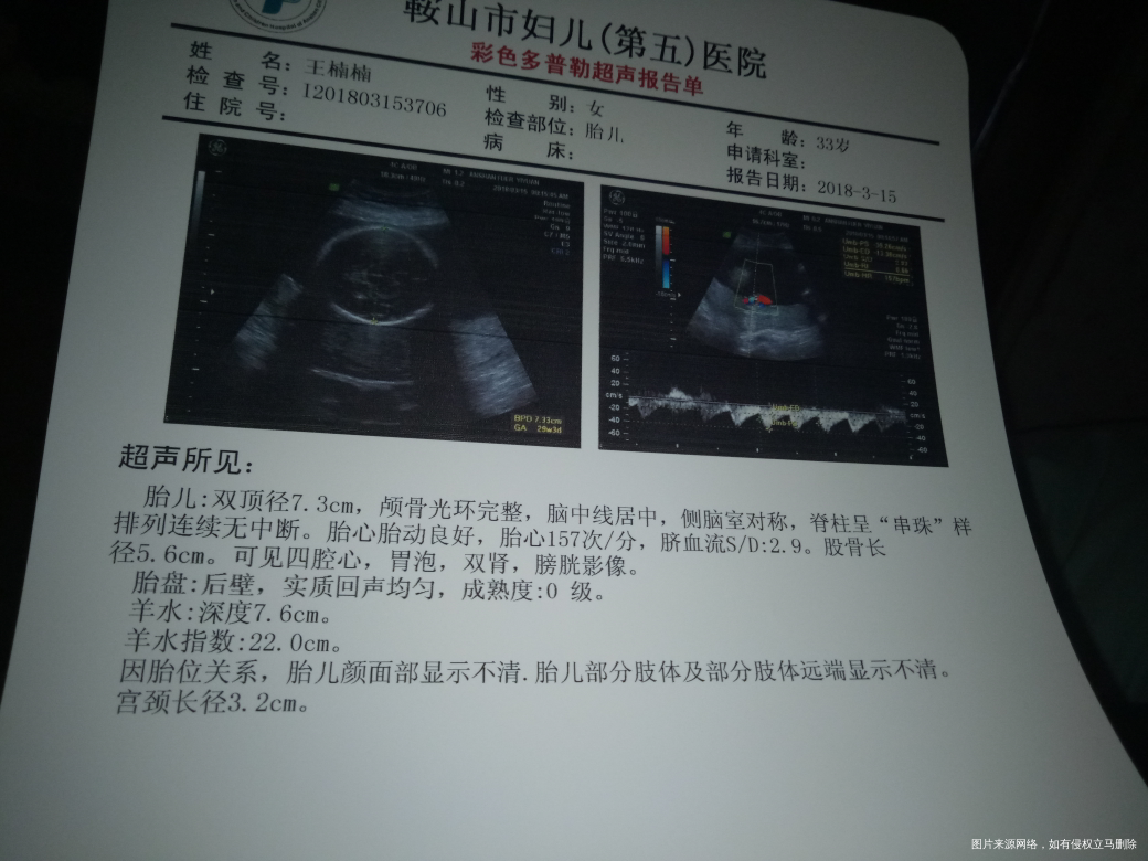 帮我看看,说我羊水过多怎么办啊,怕小孩有问题