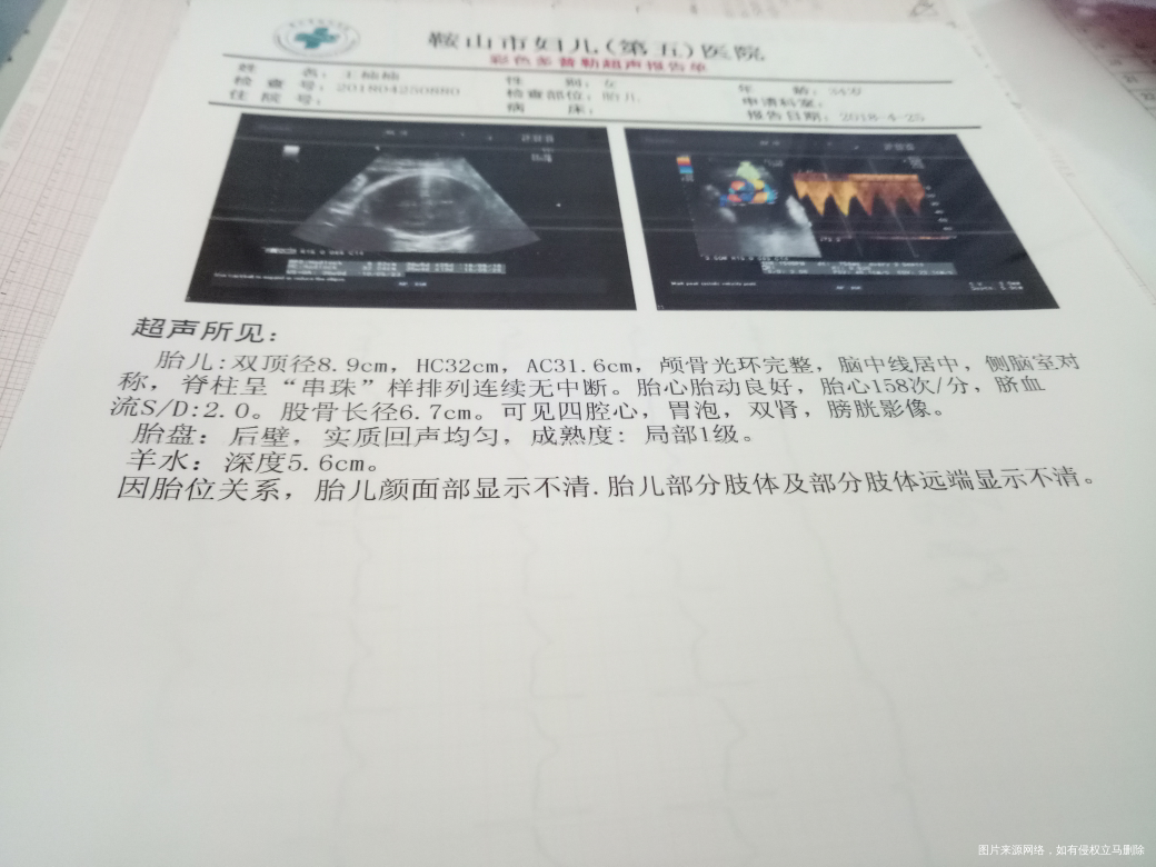 能看出我的宝宝多大了吗,现在孕35周加2