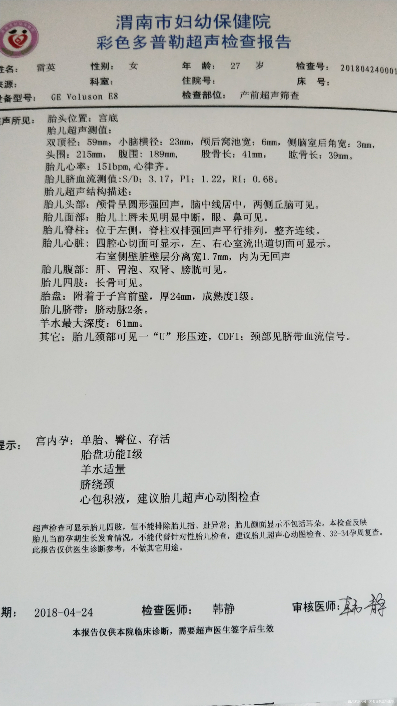 试管婴儿怀孕24周加1天