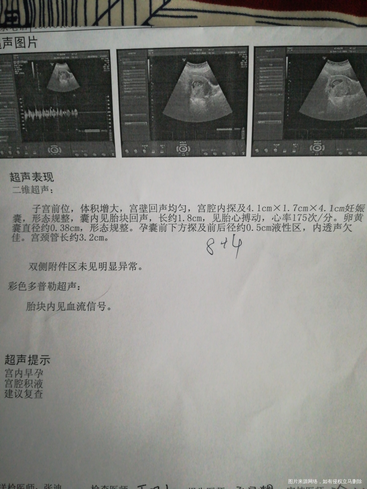 姐妹们有没有这种情况,宫腔积液到底是怎么回事?对胎儿会有影响吗?好担心啊,吃什么...