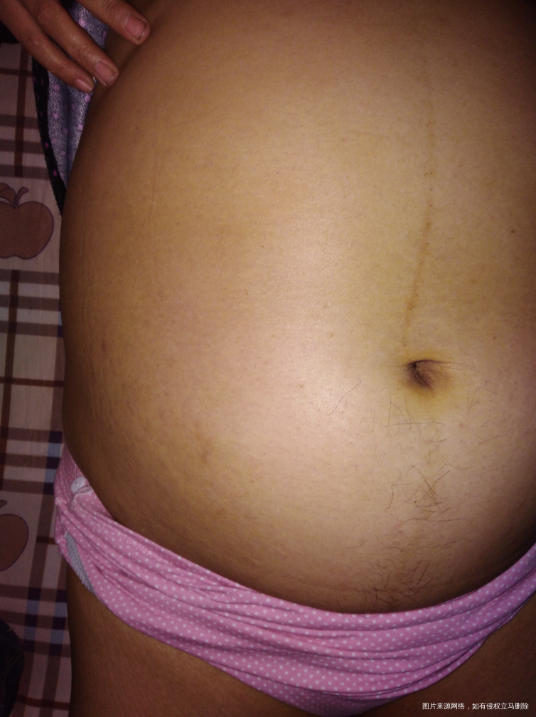 孕3o周,猜一猜宝宝性别