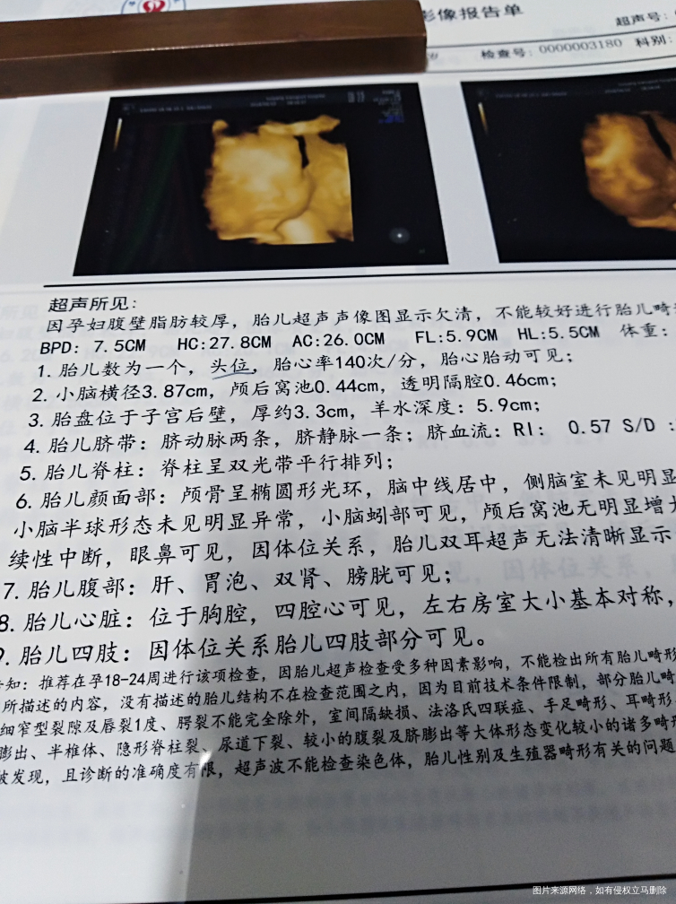 四维单子,有宝妈会看男女吗