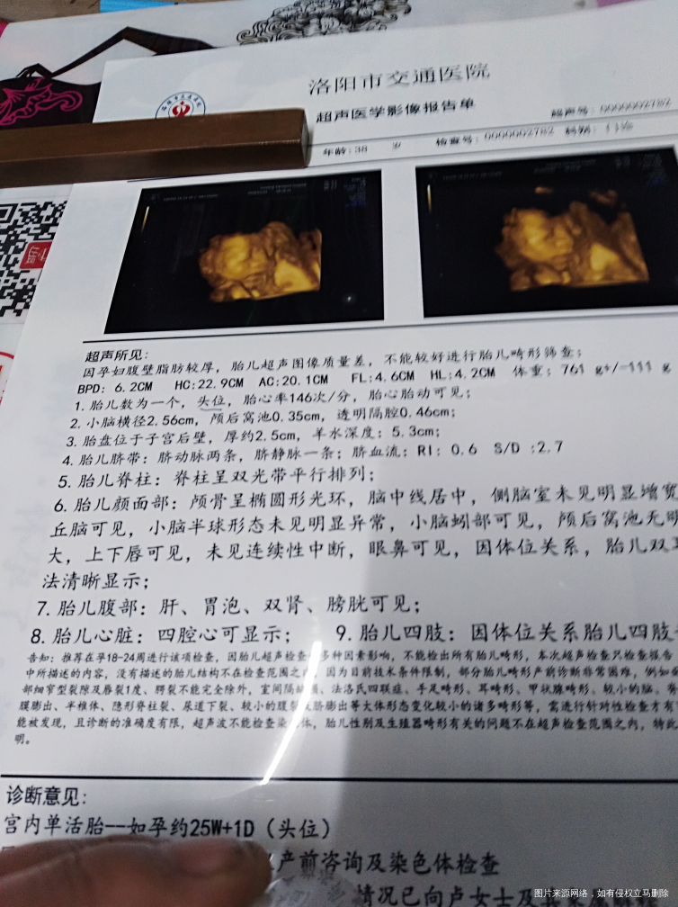 四维单子,有宝妈会看男女吗